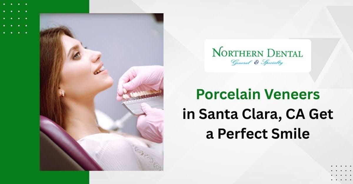 Porcelain Veneers in Santa Clara, CA: Get a Perfect Smile