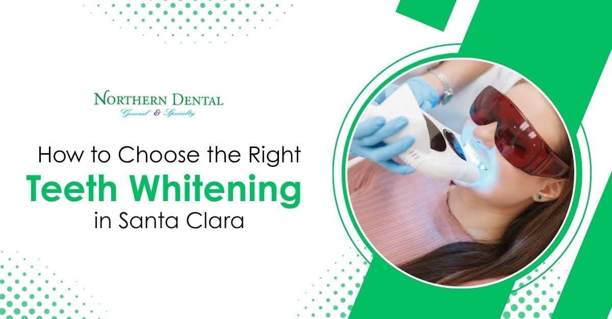 How to Choose the Right Teeth Whitening in Santa Clara