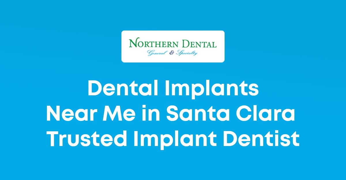 Dental Implants Near Me in Santa Clara | Trusted Implant Dentist