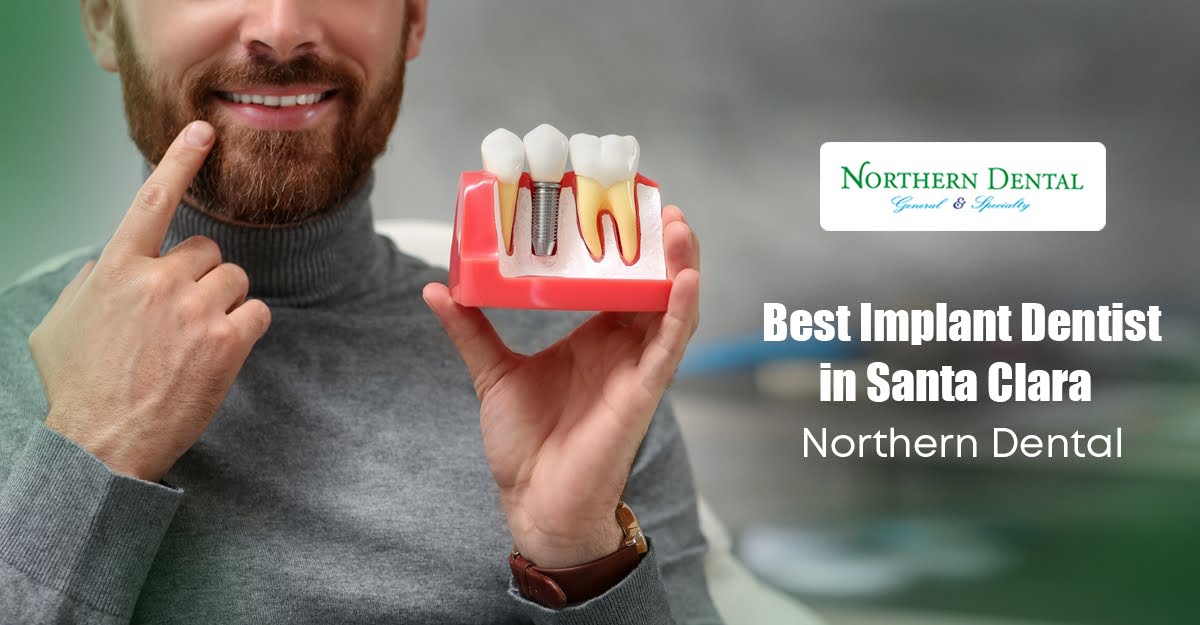 Top Implant Dentist in Santa Clara | Northern Dental