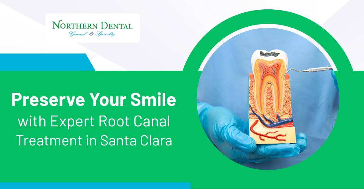 Root Canal Treatment in Santa Clara - Gentle Care