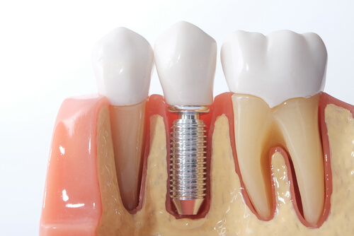 Restorative Dentistry